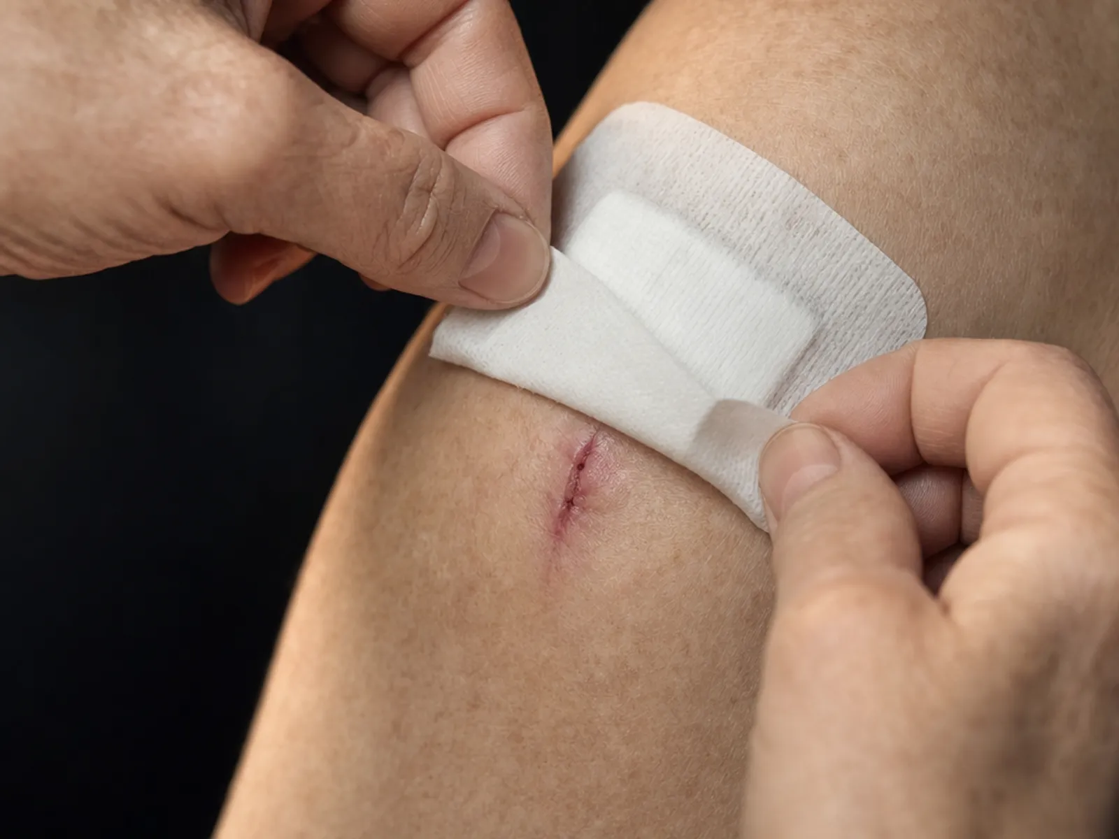 Hands pressing an adhesive dressing over a small wound on an upper arm