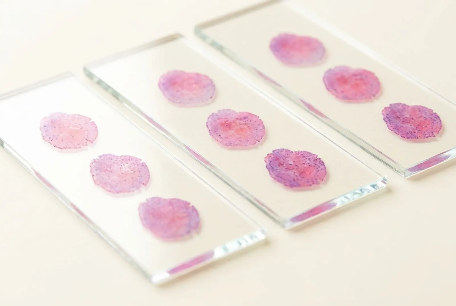 Glass slides with H&E-stained Mohs frozen sections — pink and magenta tissue discs