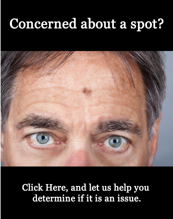 cancer spot on forehead